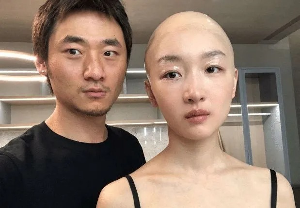 Châu Đông Vũ cũng từng xuất hiện với cái đầu trọc nhẵn thín như thế này. Tuy nhiên nếu nhìn kỹ bạn có thể nhận ra nữ diễn viên không hề xuống tóc mà chỉ dùng thuật trang điểm. Bạn thấy Châu Đông Vũ có hợp với tạo hình không tóc?