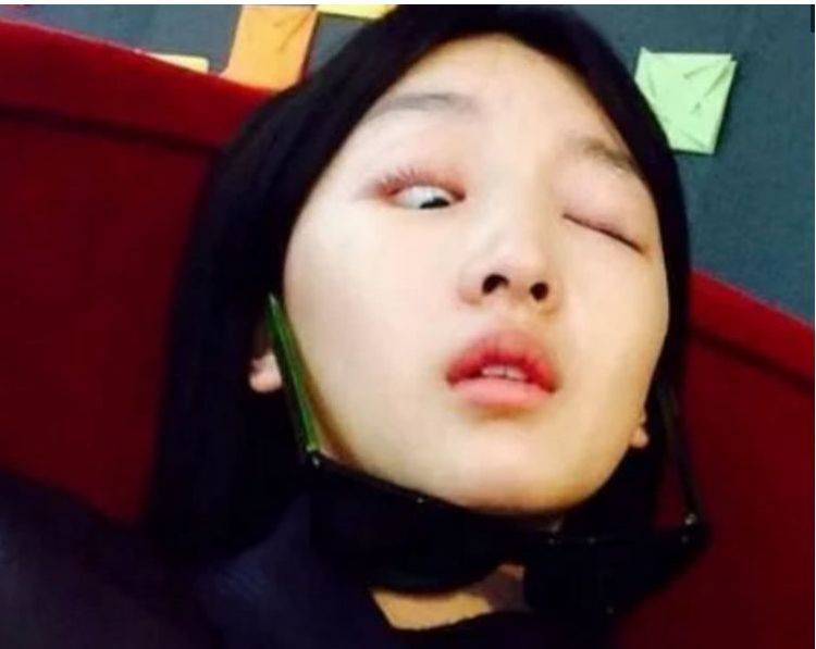 Được biết đến với kỹ năng diễn xuất tuyệt vời, ẵm về loạt giải thưởng và trở thành 'tam kim ảnh hậu' trẻ nhất lịch sử Trung Quốc nên Châu Đông Vũ chắc hẳn không muốn nhìn lại khoảnh khắc này. Không biết cô ấy đã làm kiểu gì mà có thể nhắm được một mắt, mắt kia mở nhưng nhãn cầu như muốn rớt ra ngoài.