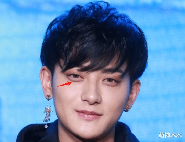 Quầng thâm đã trở thành 'đặc sản' của Hoàng Tử Thao nên không cần che giấu nữa. Ngoài ra, anh ấy còn có phần bọng mắt hơi lố, to gần bằng mắt thật.