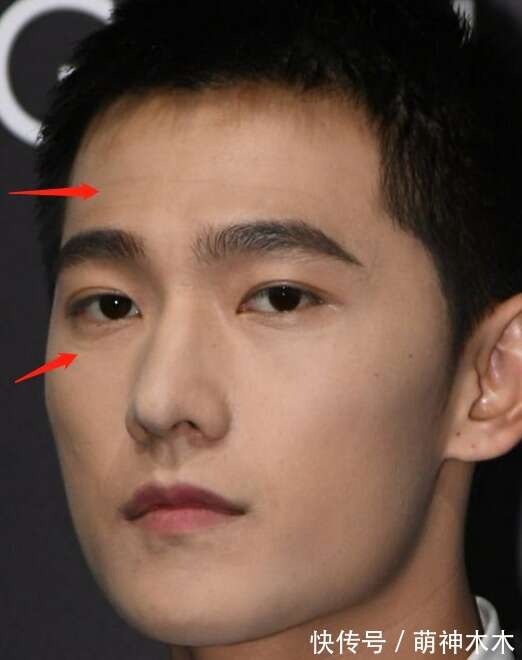 Ngoài ra, khi phóng to khuôn mặt, CDM còn soi ra trên trán và mắt Dương Dương đã có nếp nhăn. Trông anh ấy có vẻ mệt mỏi, có lẽ do thiếu nghỉ ngơi. Dương Dương cần chăm sóc làn da của mình kỹ hơn.