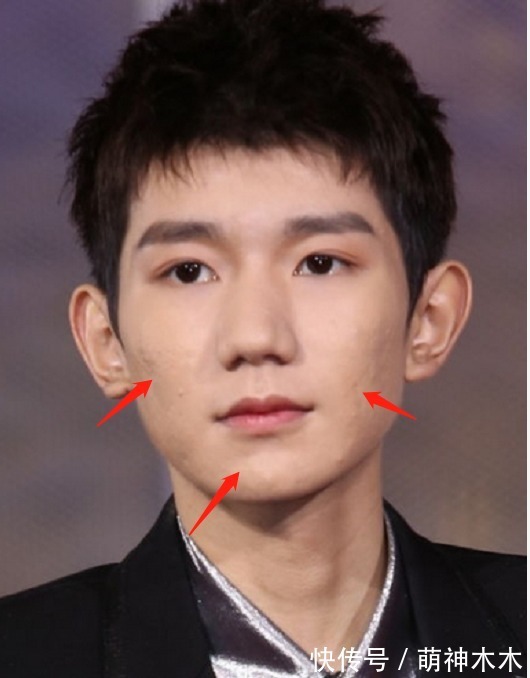 Ngược lại, nếu làn da kém sắc thì dù kỹ thuật trang điểm có tốt đến mấy cũng không thể ngăn được việc lộ khuyết điểm. Mặt của Vương Nguyên có nhiều mụn và dù đánh phấn thì vẫn có những chiếc mụn không che được. Nếu nhìn kỹ, bạn sẽ thấy mụn bị lộ ra.