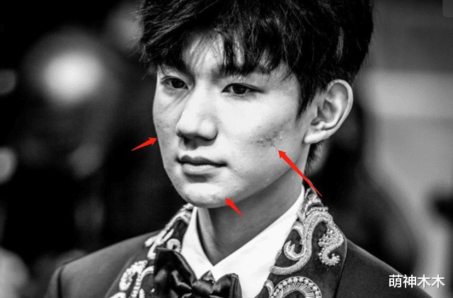 Có vẻ như những bức ảnh điển trai của Vương Nguyên phải qua chỉnh sửa kỹ lưỡng. Là một ngôi sao, lộ ra những bức ảnh như thế này không tốt chút nào. Vương Nguyên cần chăm da kĩ hơn nữa.