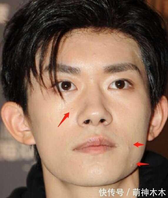 Soi khuyết điểm mỹ nam Cbiz: Dương Dương lộ nếp nhăn, Vương Nguyên mặt chi chít mụn, Nhất Bác da đẹp xỉu