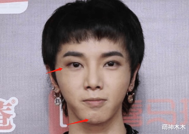 Hoa Thần Vũ cũng là sao nam có làn da xấu của Cbiz. Lần nào tham gia chương trình anh ấy cũng trang điểm rất đậm để che khuyết điểm nhưng cằm lẹm, nếp nhăn quanh mắt và những vết sẹo lõm trên mặt thì không thể nào che được.