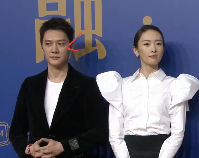 Không có bàn tay 'săn sóc' của Triệu Lệ Dĩnh, dường như Phùng Thiệu Phong lộ rõ dấu hiệu lão hóa Không có bàn tay 'săn sóc' của Triệu Lệ Dĩnh, dường như Phùng Thiệu Phong lộ rõ dấu hiệu lão hóa