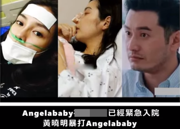 Rộ tin đồn Huỳnh Hiểu Minh 'ra tay' với Angelababy tới mức nhập viện - Ảnh 1
