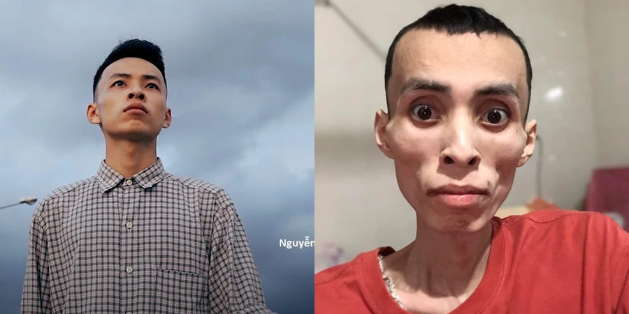 Được biết trước khi trút hơi thở cuối cùng rapper Chú Nghi đã trải qua 8 lần hóa trị đầy đau đớn. Những ngày cuối đời anh phải chịu nỗi đau về thể xác khi buộc phải thở oxy, cơ thể suy nhược