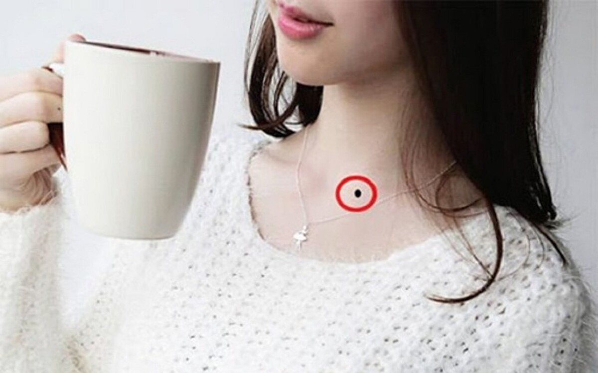 Nốt ruồi nằm trước cổ