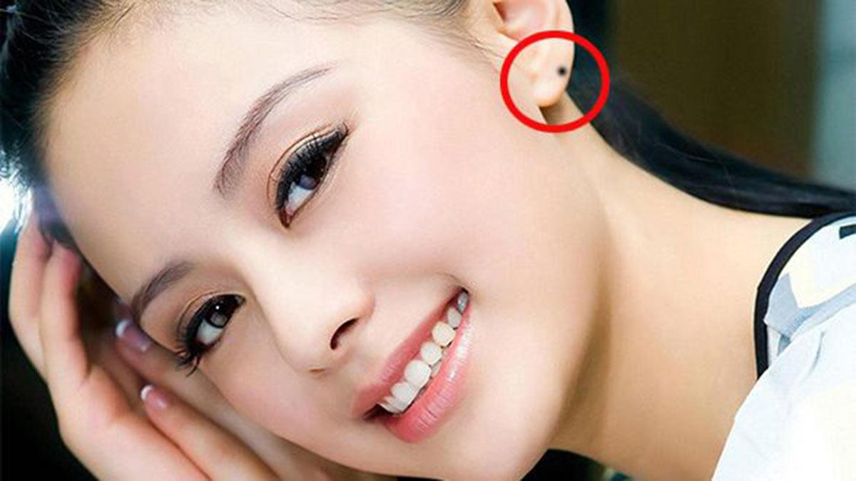 Nốt ruồi trên tai phải