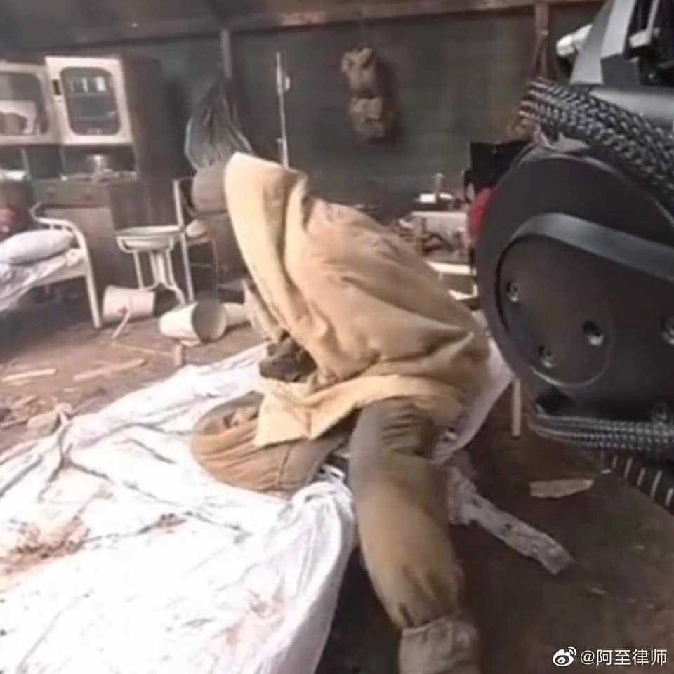 Hot search: Dịch Dương Thiên Tỉ giấu một bên chân bị thương trước ống kính máy quay