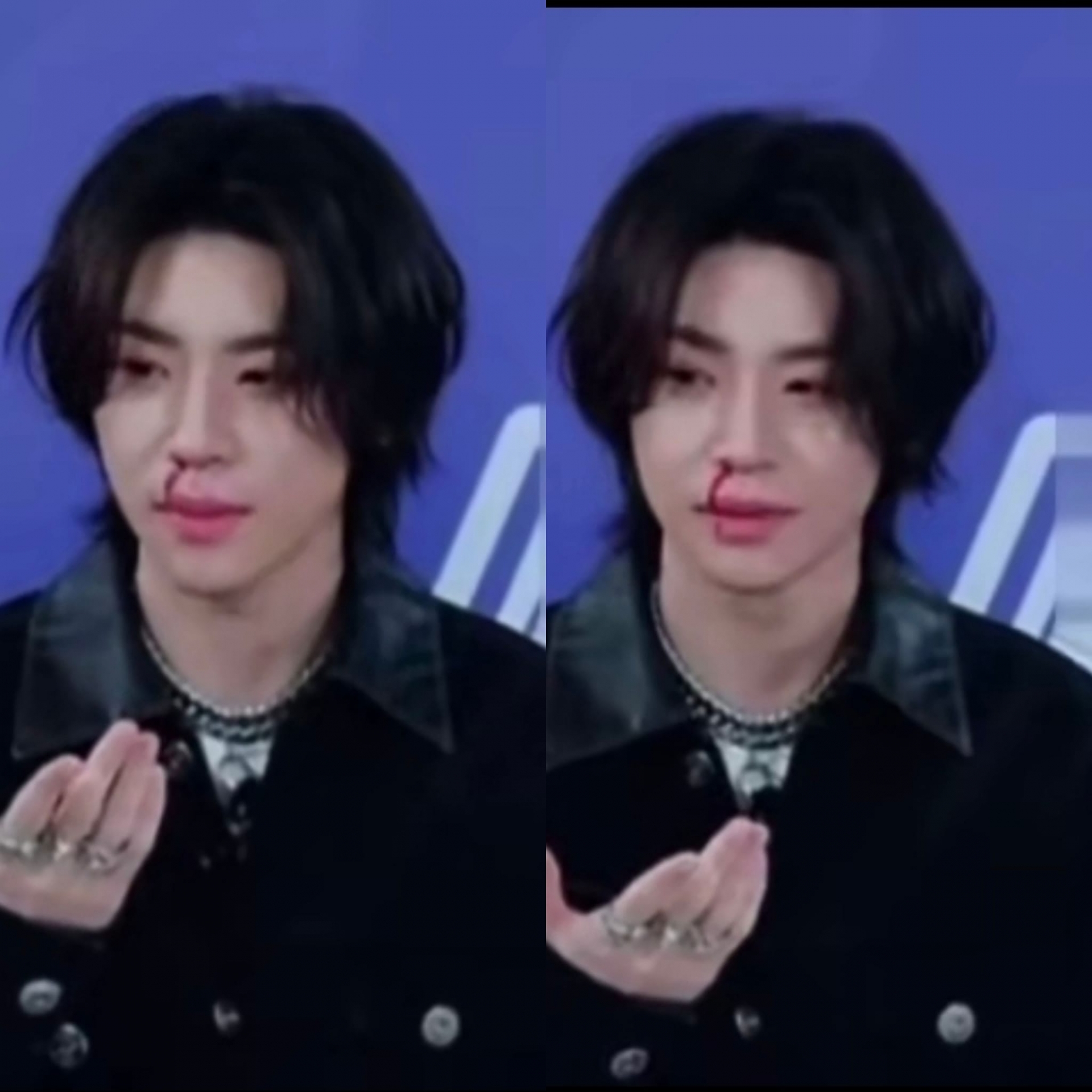 Trong buổi livestream của nhãn hàng tối qua, Tiểu Quỷ Vương Lâm Khải bất ngờ bị chảy máu cam, tuy nhiên nhân viên công tác không có phản ứng. Mãi sau nam nghệ sĩ mới nói: 'Em bị chảy máu cam rồi.' Lúc này MC mời Tiểu Quỷ vào trong nghỉ ngơi, sau đó nhân viên mới đem khăn giấy tới. Hiện CDM đang chỉ trích nhân viên công tác vô tâm