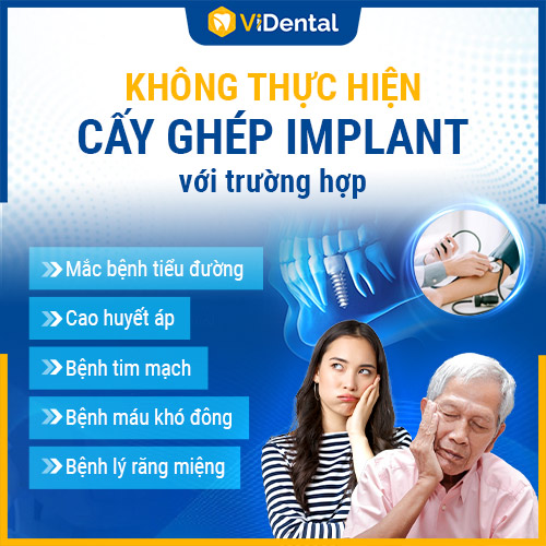 5 Tiêu chuẩn vàng trồng răng Implant không đau, bền đẹp tại ViDental - Ảnh 1 5 Tiêu chuẩn vàng trồng răng Implant không đau, bền đẹp tại ViDental - Ảnh 1
