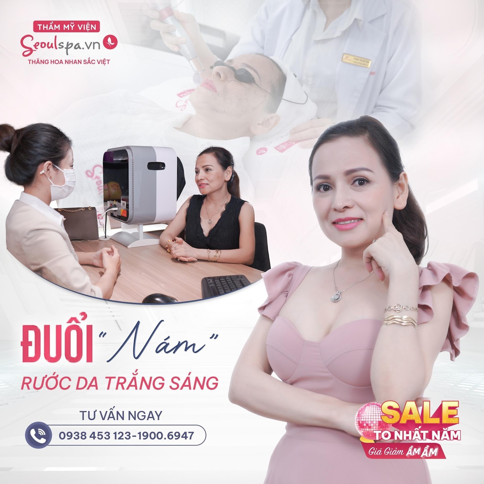 Điều trị nám an toàn, hiệu quả chỉ sau 1 liệu trình