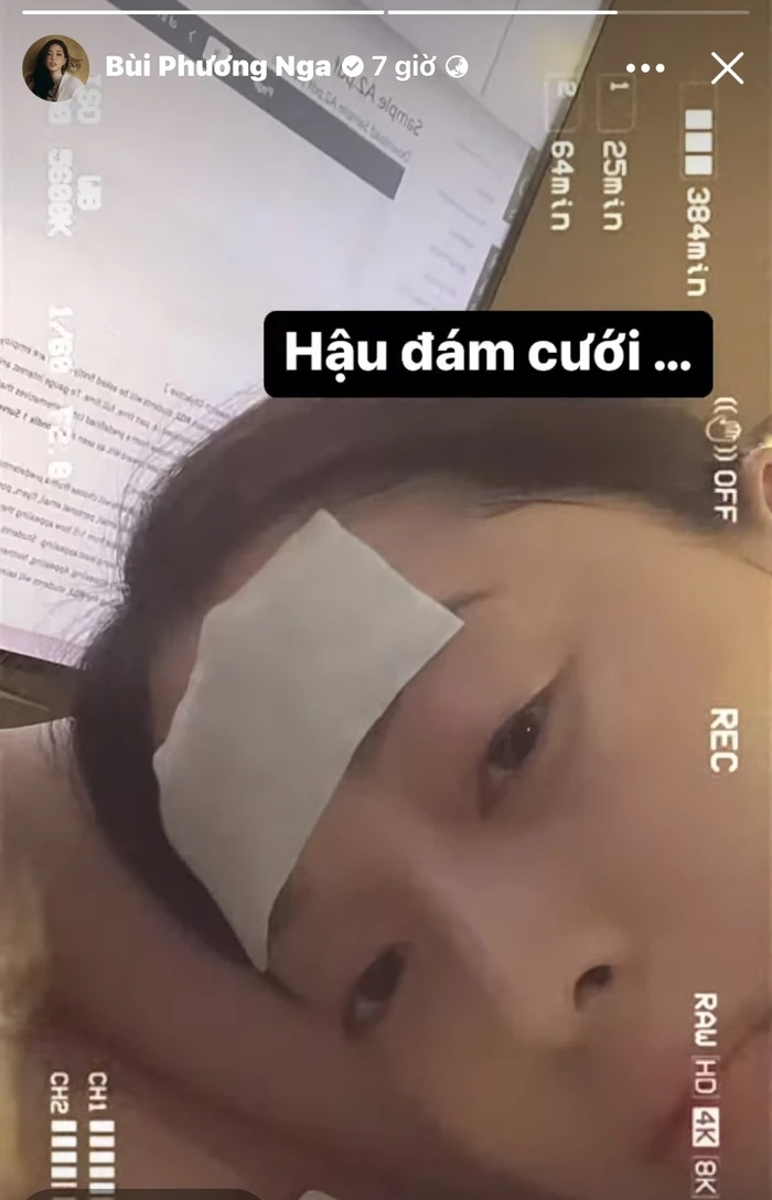 Á hậu Phương Nga gặp vấn đề sức khỏe sau đám cưới. Ảnh chụp màn hình