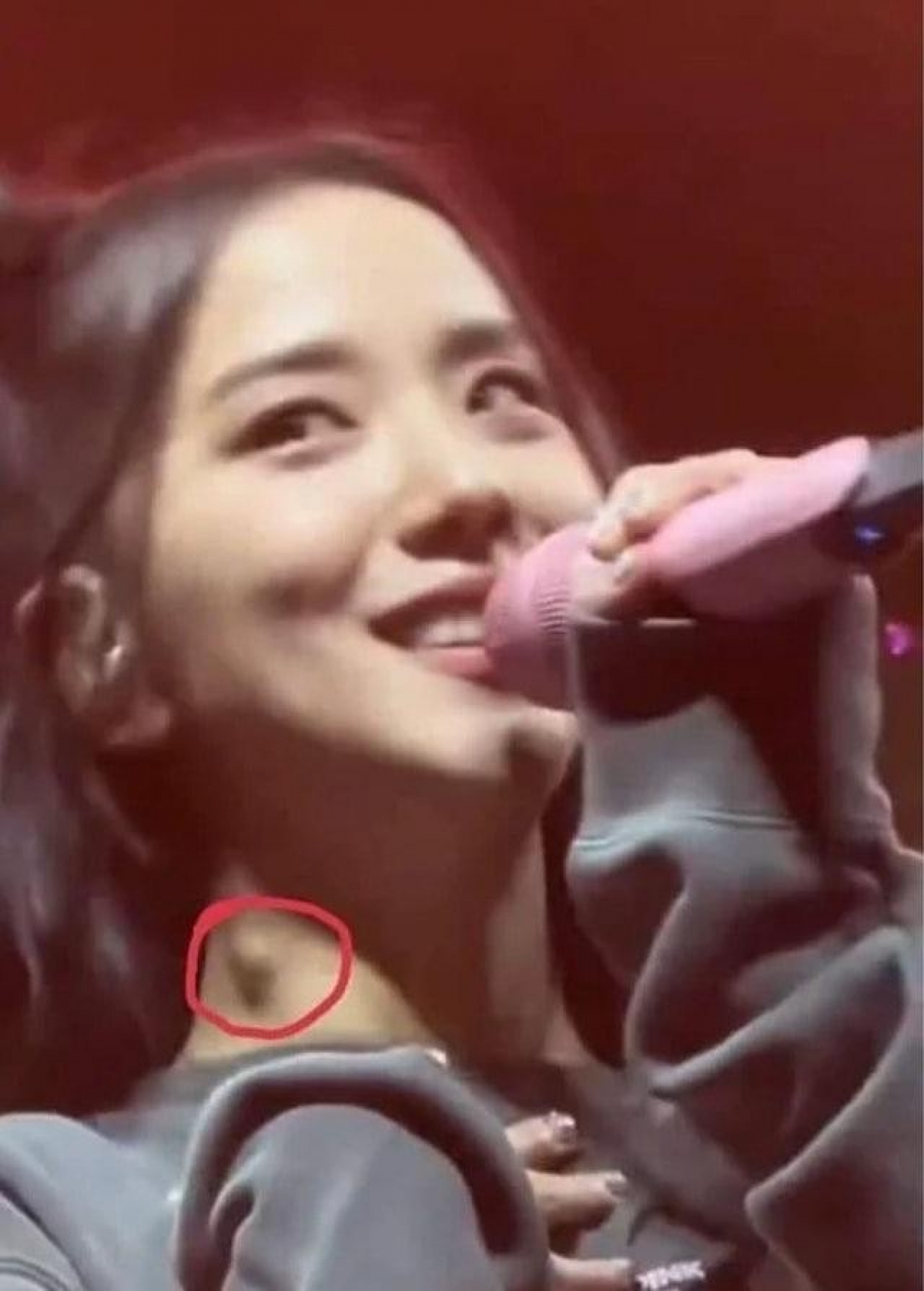 Tình trạng của Jisoo khiến người hâm mộ lo lắng. Ảnh HK01