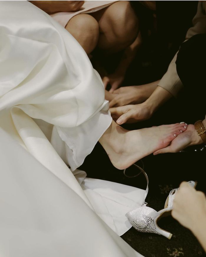 Á hậu Thùy Dung bị bỏng lạnh ở chân. Á hậu Thùy Dung bị bỏng lạnh ở chân.