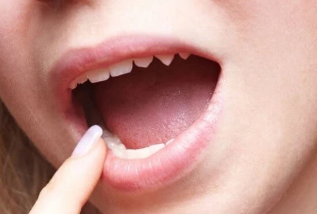 Khô miệng khi ngủ dậy có thể là dấu hiệu sớm cảnh báo bệnh tiểu đường. Ảnh minh họa. Khô miệng khi ngủ dậy có thể là dấu hiệu sớm cảnh báo bệnh tiểu đường. Ảnh minh họa.