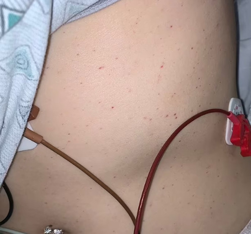 Juliana Pascarella mắc chứng ban xuất huyết giảm tiểu cầu vô căn, một chứng rối loạn máu hiếm gặp.