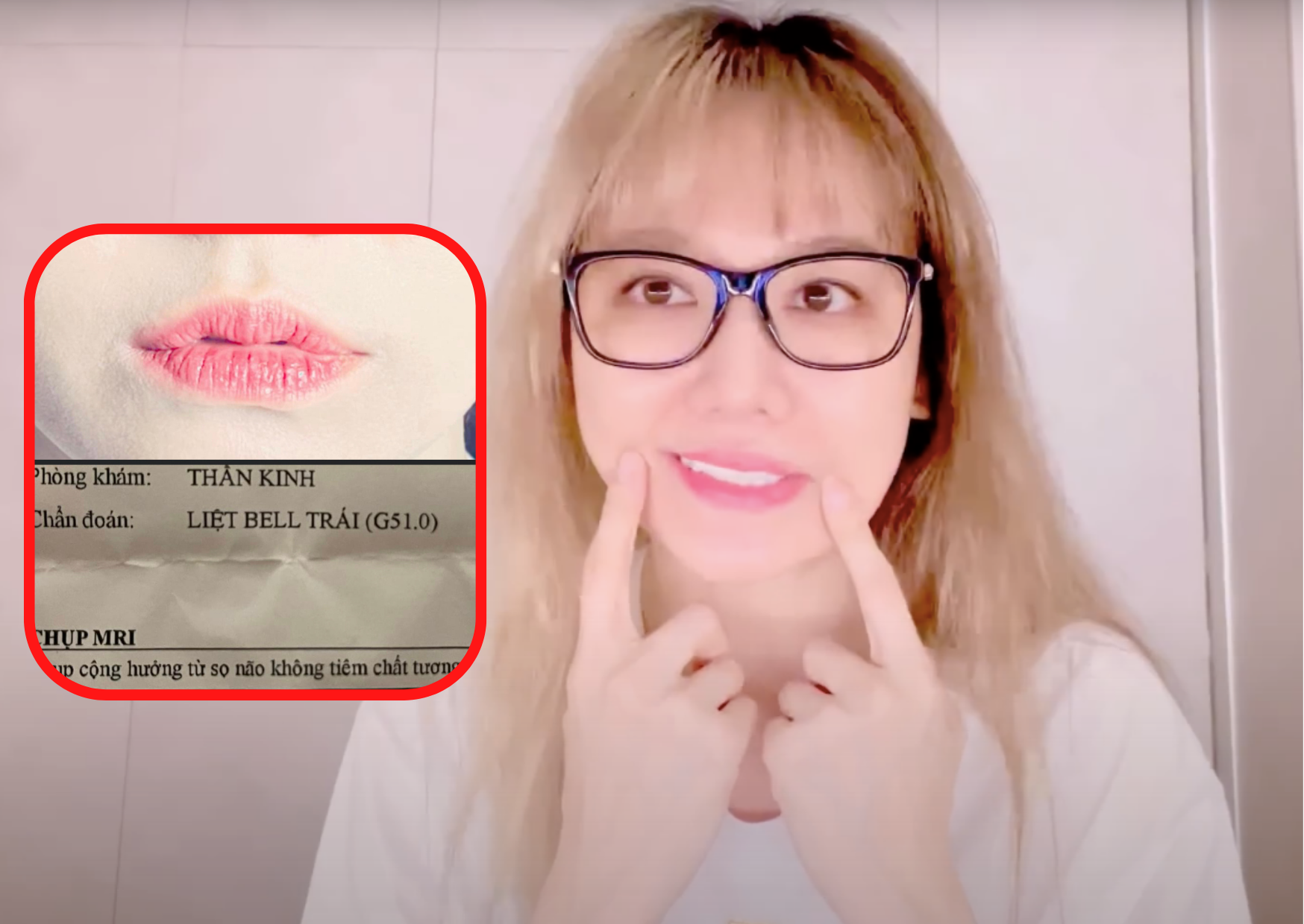 Hari Won khiến fan lo lắng khi bệnh tật triền miên