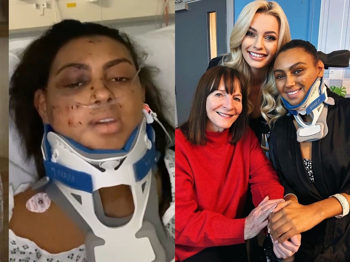 Darcey Corria hiện đã tỉnh táo, tuy nhiên vẫn phải sử dụng nẹp cổ để cố định vết thương. Rất đông người thân lẫn đồng nghiệp đã đến bệnh viện để thăm hỏi Darcey Corri.