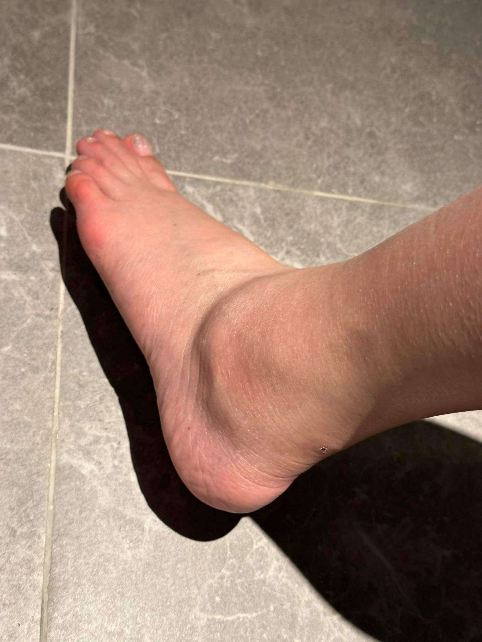 Thanh Thanh Huyền khiến người hâm mộ lo lắng khi đăng tải hình ảnh đôi bàn chân sưng húp