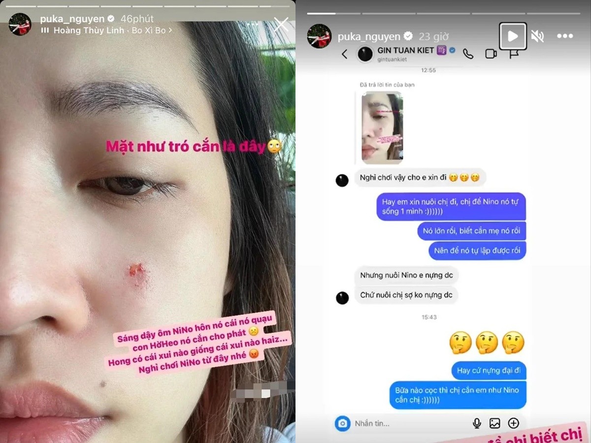 Động thái của Gin Tuấn Kiệt khi 'bạn gái tin đồn' bị thú cưng tấn công đến rách mặt