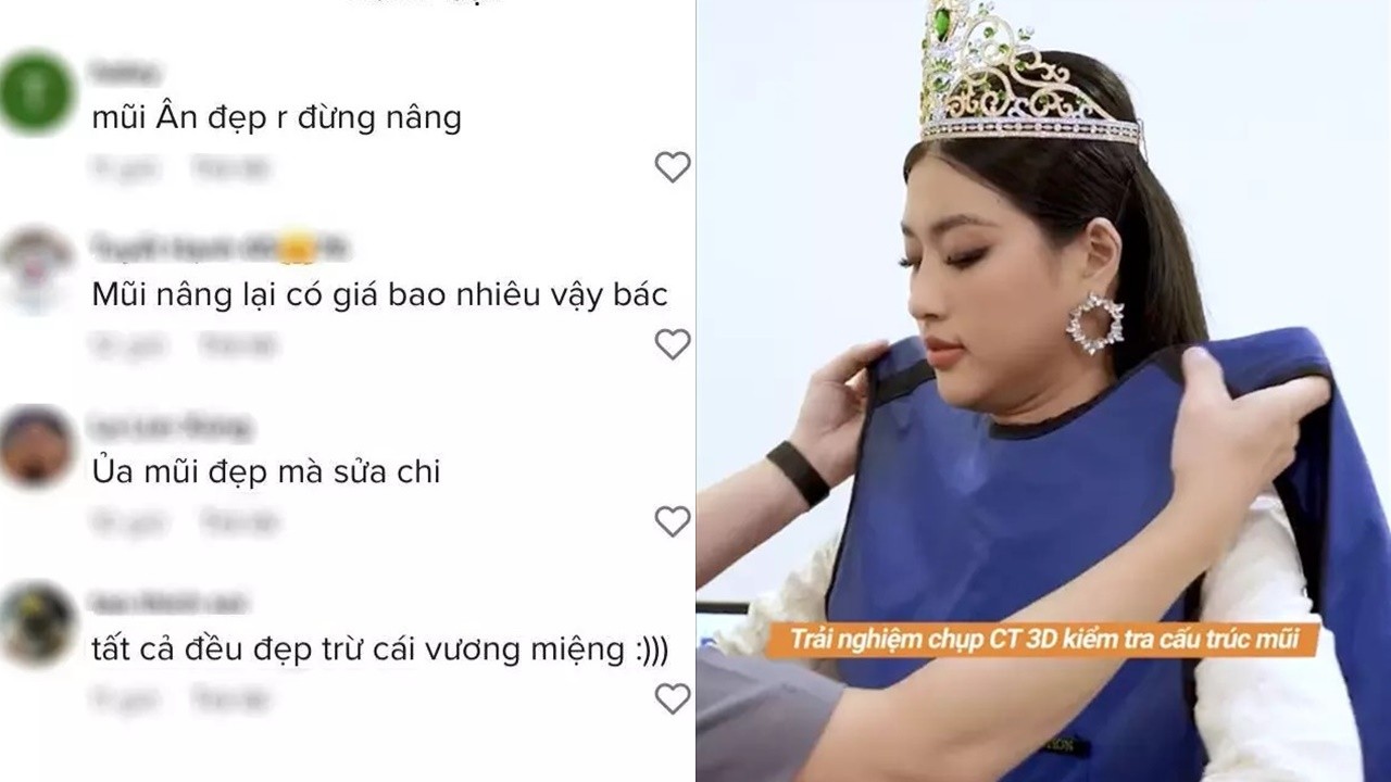Dàn hậu và chuyện 'dao kéo': Thanh Thủy - Kiều Loan thừa nhận, fan lo cho Thùy Tiên - Thiên Ân 7 Dàn hậu và chuyện 'dao kéo': Thanh Thủy - Kiều Loan thừa nhận, fan lo cho Thùy Tiên - Thiên Ân 7