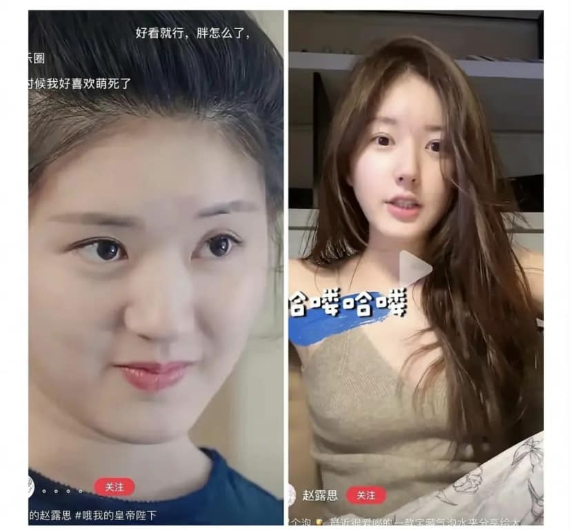 Cư dân mạng đặt nhiều nghi vấn về chiếc mũi của Triệu Lộ Tư. Nhiều người cho rằng nữ diễn viên đã đụng chạm dao kéo, tuy nhiên các fan lại phản pháo rằng do thay đổi cách trang điểm nên có sự khác biệt