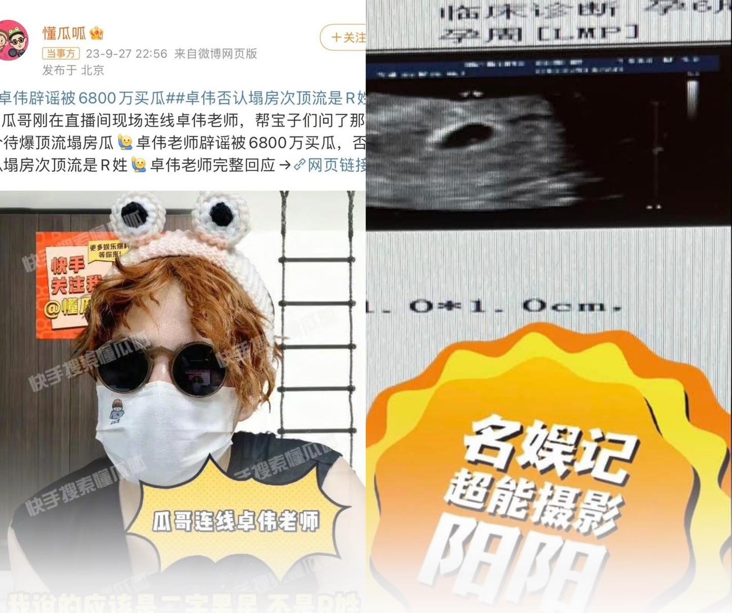 No.1 Hot search Weibo: Paparazzi đình đám Trác Vỹ tuyên bố sẽ khui scandal 'sập phòng' của một sao nam tên 2 chữ. Theo tiết lộ, sao nam này đóng phim cổ trang và sắp lên đỉnh lưu. Blogger cho biết thêm hiện đang nắm giữ ảnh siêu âm của nhà gái. Trác Vỹ cũng phủ nhận đã nhận 68 triệu tệ của sao nam để không khui 'dưa'. Bên dưới bài đăng, một số cái tên được netizen comment bao gồm: Thành Nghị, Cung Tuấn, Đặng Vi, Vu Thích No.1 Hot search Weibo: Paparazzi đình đám Trác Vỹ tuyên bố sẽ khui scandal 'sập phòng' của một sao nam tên 2 chữ. Theo tiết lộ, sao nam này đóng phim cổ trang và sắp lên đỉnh lưu. Blogger cho biết thêm hiện đang nắm giữ ảnh siêu âm của nhà gái. Trác Vỹ cũng phủ nhận đã nhận 68 triệu tệ của sao nam để không khui 'dưa'. Bên dưới bài đăng, một số cái tên được netizen comment bao gồm: Thành Nghị, Cung Tuấn, Đặng Vi, Vu Thích