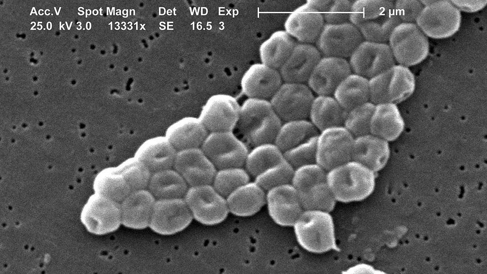 Hình ảnh kính hiển vi của vi khuẩn thuộc chi Acinetobacter. Các chủng vi khuẩn có khả năng chịu khô hạn cực cao được tìm thấy ở sa mạc Atacama của Chile. (Ảnh: Janice Carr/Wikimedia)