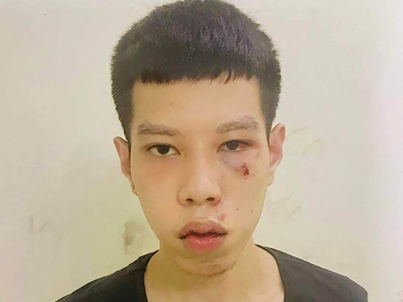 Thanh niên Hà Nội cướp 16 triệu của cụ bà vừa lĩnh lương hưu. Ảnh Vietnamnet Thanh niên Hà Nội cướp 16 triệu của cụ bà vừa lĩnh lương hưu. Ảnh Vietnamnet