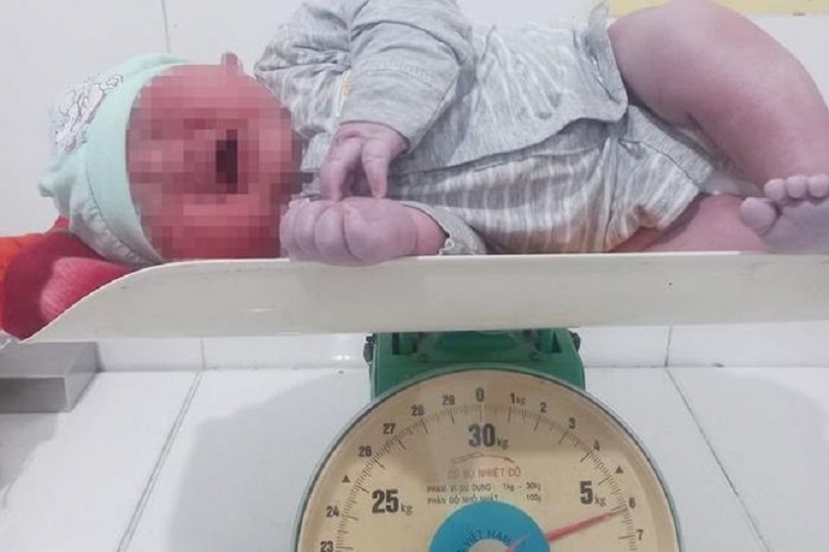 Bé trai chào đời có cân nặng 6kg (Ảnh: Bệnh viện cung cấp). Bé trai chào đời có cân nặng 6kg (Ảnh: Bệnh viện cung cấp).