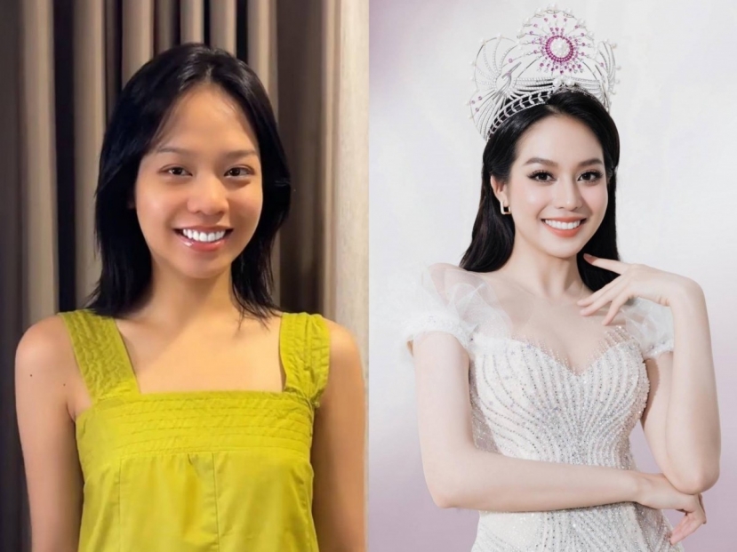 Hoa hậu Thanh Thủy trước và sau khi thẩm mỹ có nhiều điểm khác. Ảnh internet Hoa hậu Thanh Thủy trước và sau khi thẩm mỹ có nhiều điểm khác. Ảnh internet