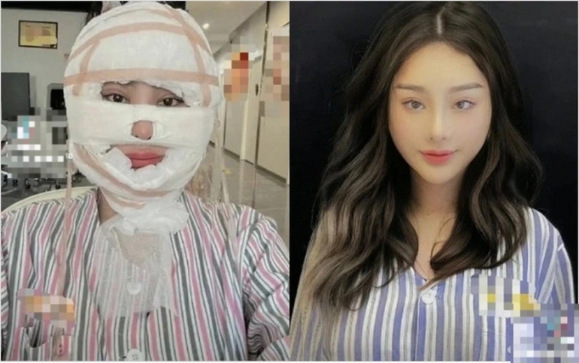Lâm Khánh Chi tiết lộ sự thật đằng sau hành trình trùng tu nhan sắc - Ảnh 1 Lâm Khánh Chi tiết lộ sự thật đằng sau hành trình trùng tu nhan sắc - Ảnh 1