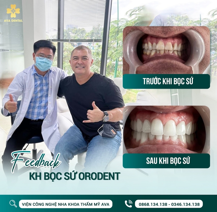 AVA Dental - thương hiệu đẳng cấp cho bạn hàm răng tươi xinh AVA Dental - thương hiệu đẳng cấp cho bạn hàm răng tươi xinh