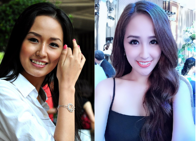 Mai Phương Thúy nhiều năm bị đồn niềng răng. Ảnh FBNV Mai Phương Thúy nhiều năm bị đồn niềng răng. Ảnh FBNV