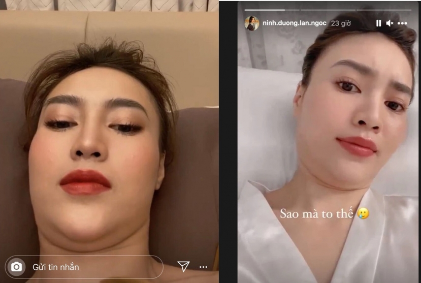 Nữ diễn viên không ngại phơi bày khuyết điểm của mình. Ảnh internet Nữ diễn viên không ngại phơi bày khuyết điểm của mình. Ảnh internet