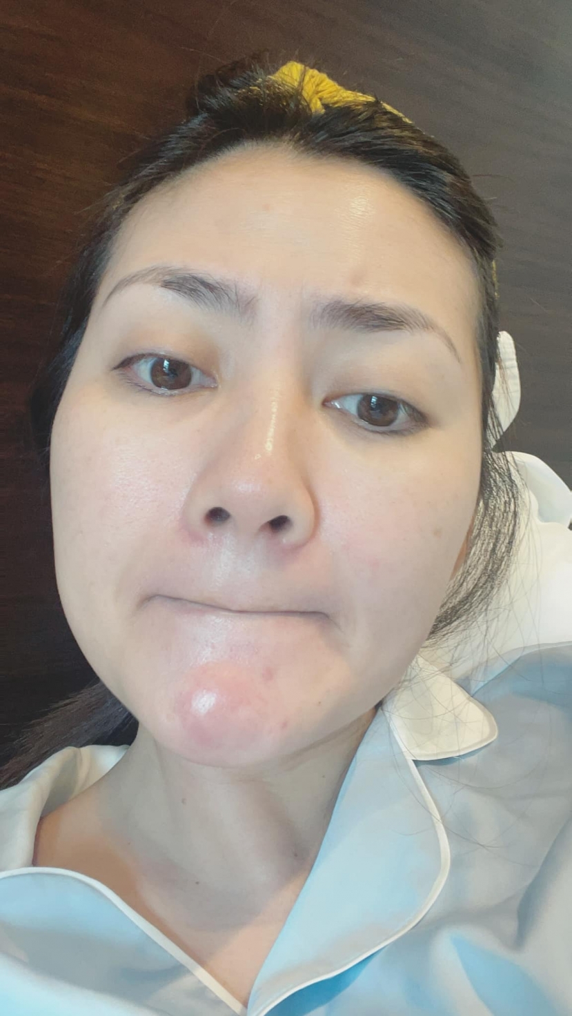 Dù có một chút khuyết điểm trên mặt nhưng Ngọc Lan vẫn xinh đẹp ở tuổi U40. Ảnh FBNV Dù có một chút khuyết điểm trên mặt nhưng Ngọc Lan vẫn xinh đẹp ở tuổi U40. Ảnh FBNV
