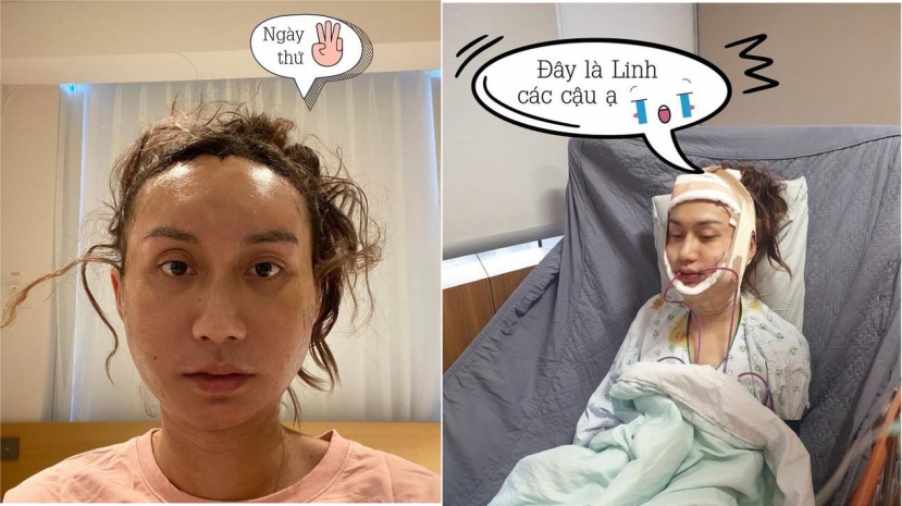 Vén màn góc khuất khó nói trong đời tư của Lynk Lee trước khi được sống thật với giới tính - Ảnh 1 Vén màn góc khuất khó nói trong đời tư của Lynk Lee trước khi được sống thật với giới tính - Ảnh 1