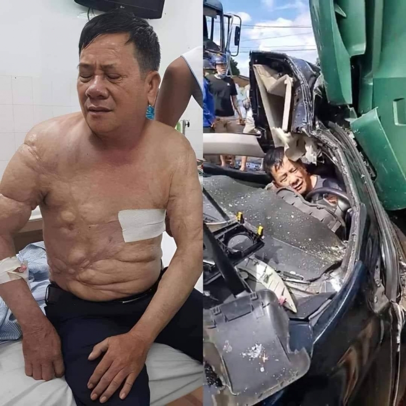 Tài xế Sinh may mắn sống sót sau vụ tai nạn kinh hoàng Tài xế Sinh may mắn sống sót sau vụ tai nạn kinh hoàng