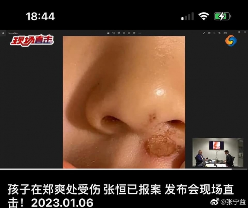 Hình ảnh mà Trương Hằng tung ra cho truyền thông. Hình ảnh mà Trương Hằng tung ra cho truyền thông.