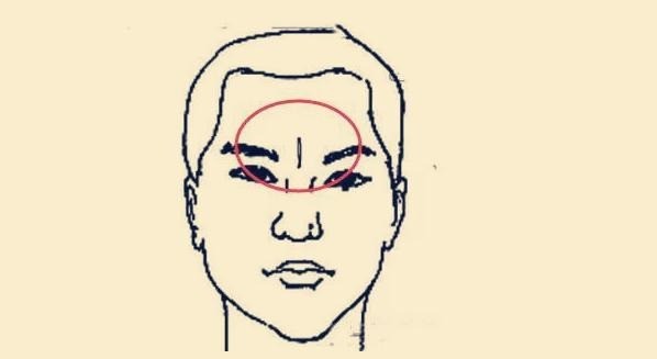 Ấn đường quá rộng hay quá hẹp cũng đều là nét tướng không đẹp. Ấn đường quá rộng hay quá hẹp cũng đều là nét tướng không đẹp.