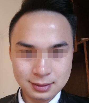 Người có đôi tai áp sát mặt thì chu đáo, quyết đoán, dễ đạt được thành tựu trong đời. Ảnh minh họa: Internet Người có đôi tai áp sát mặt thì chu đáo, quyết đoán, dễ đạt được thành tựu trong đời. Ảnh minh họa: Internet