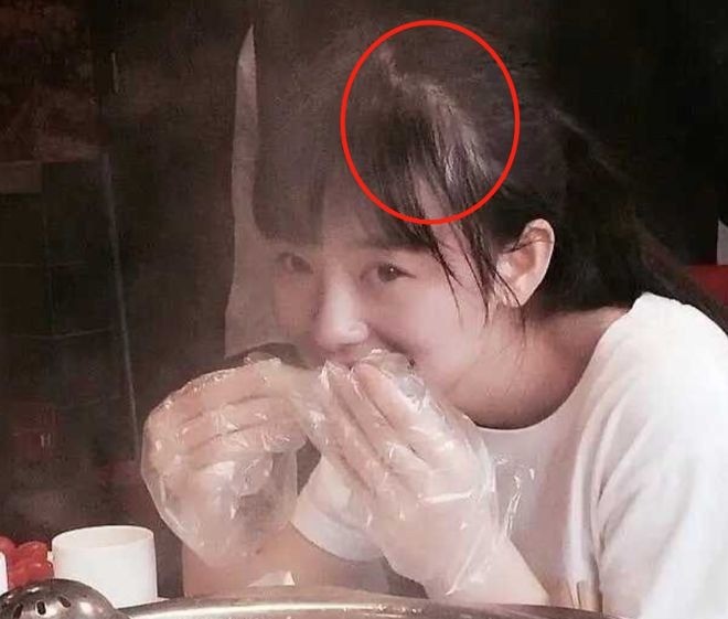 Đường chân tóc lộ rõ. Đường chân tóc lộ rõ.