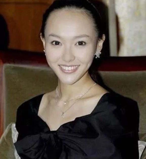 Đường Yên khi để lộ đường chân tóc. Đường Yên khi để lộ đường chân tóc.