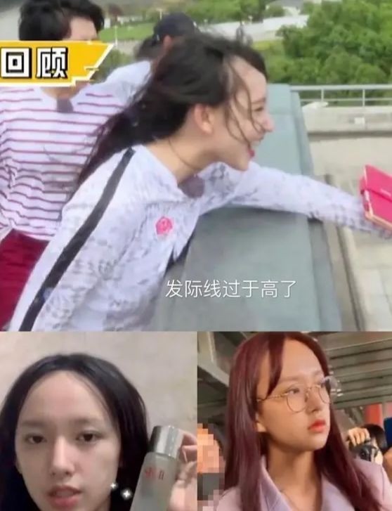 Trình Tiêu bị hói dù còn rất trẻ. Trình Tiêu bị hói dù còn rất trẻ.