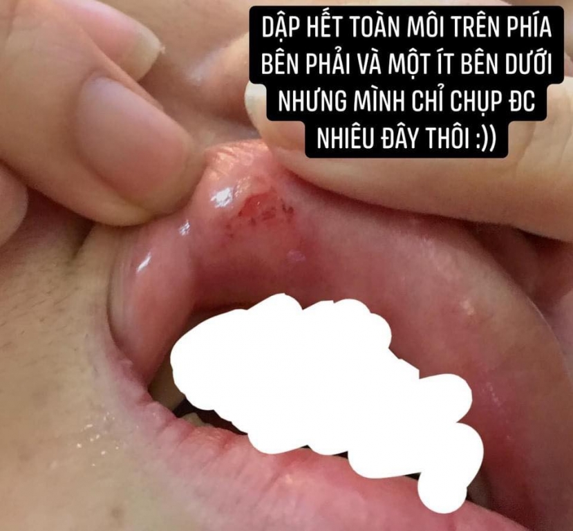 Ảnh: FBNV Ảnh: FBNV