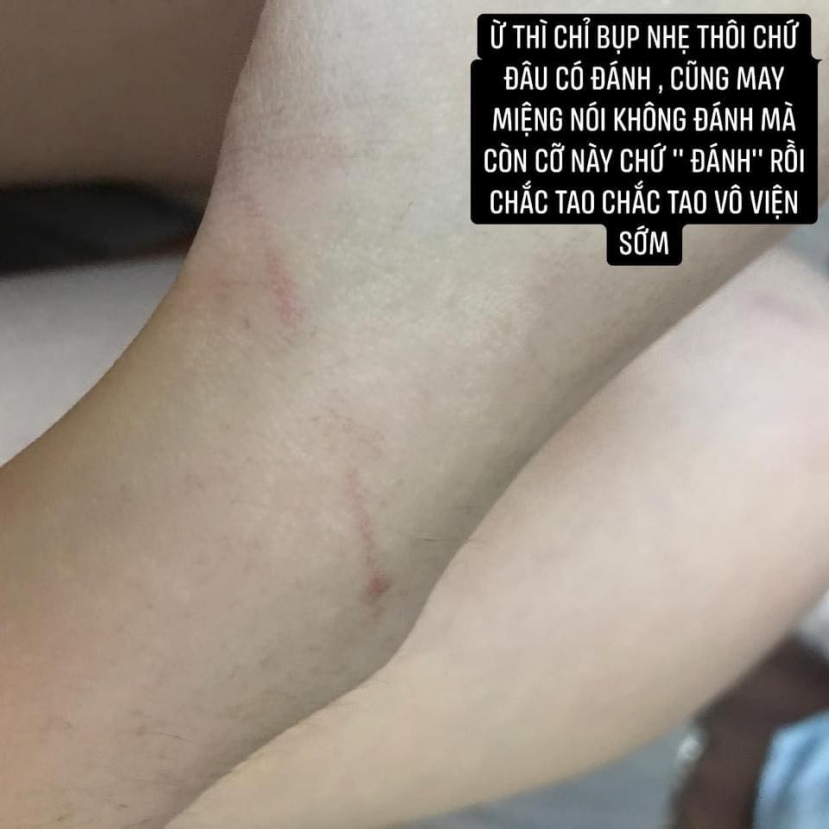Ảnh: FBNV Ảnh: FBNV