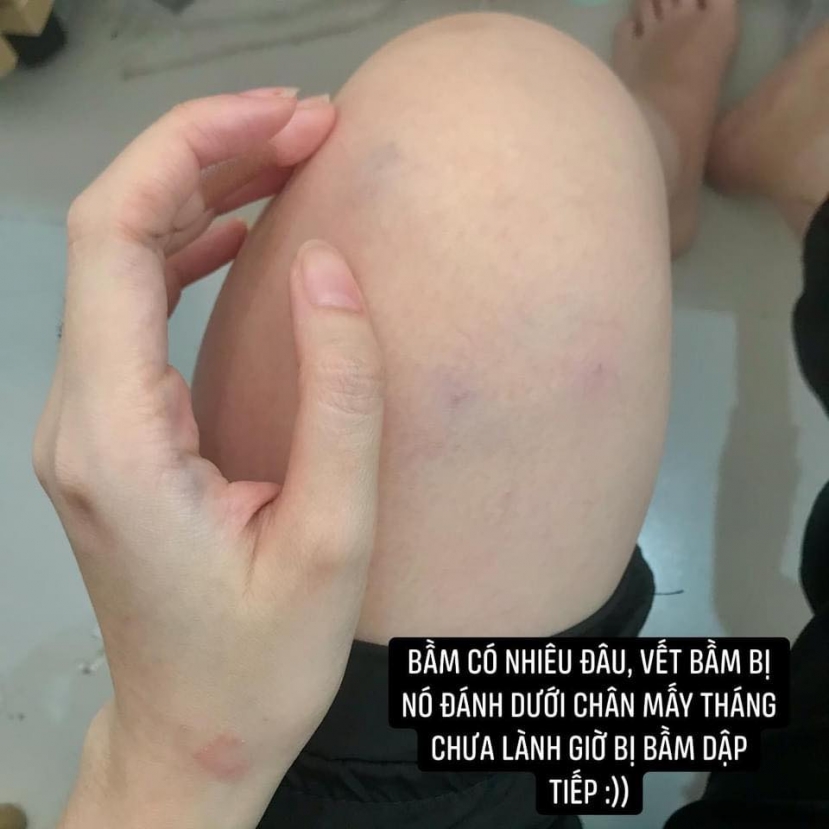 Ảnh: FBNV Ảnh: FBNV