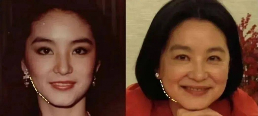 Lưu Diệc Phi và 17 sao Hoa ngữ thất bại ê chề trong cuộc chiến níu giữ thanh xuân - Ảnh 25 Lưu Diệc Phi và 17 sao Hoa ngữ thất bại ê chề trong cuộc chiến níu giữ thanh xuân - Ảnh 25